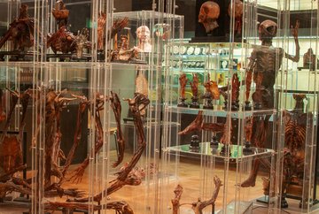 Museo anatómico de Innsbruck